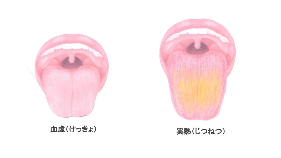 体質を東洋医学の視点から理解し対策しよう 五臓１０タイプ診断テスト Tc鍼灸マッサージ院